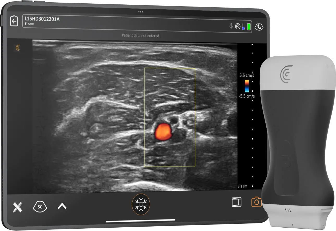 Ultrasound Specialized for Aesthetics