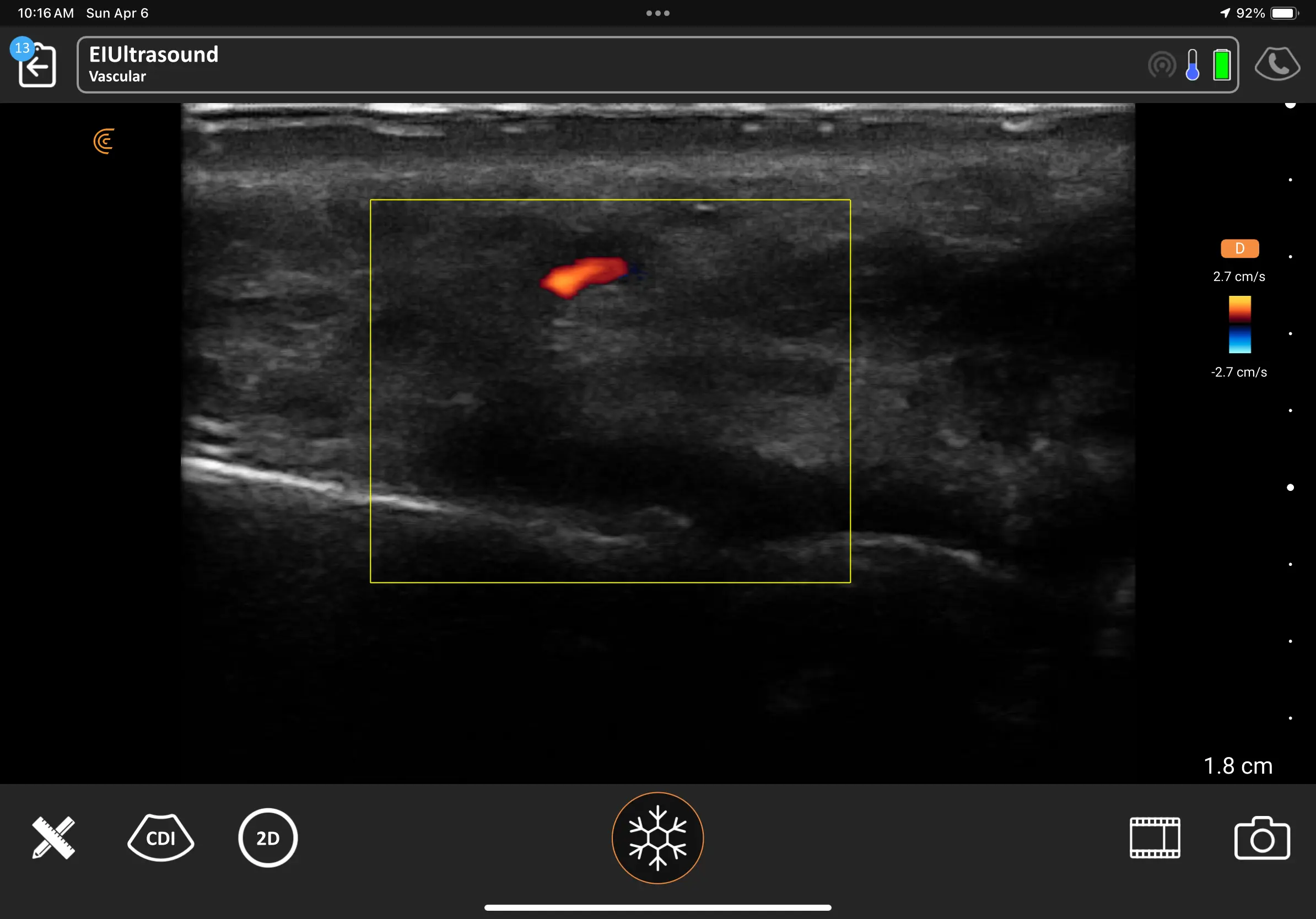 Ultrasound Specialized for Aesthetics